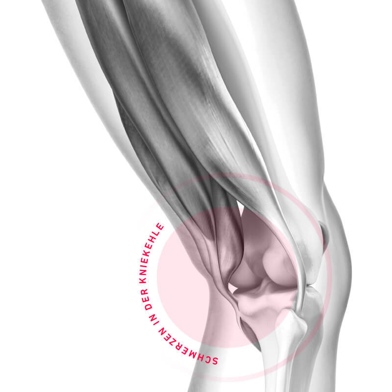 Schematische weergave Pijn achter in de knie